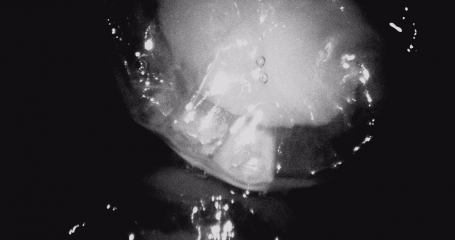 Infravizní režim kamery Vistacam iX HD - kaz zobrazen bílým lichoběžníkem na spodním okraji zubu